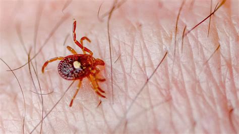 Tick Bite Pictures Symptoms What Does A Tick Bite Look Like? | lupon.gov.ph