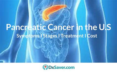 What Are The Stages Of Pancreatic Cancer? Know More About The Symptoms ...