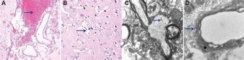 Brain tissue histology in rats in the trauma group 1 hour after diffuse... | Download Scientific ...