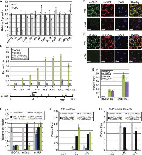 DOT1L regulates dystrophin expression and is critical for cardiac function