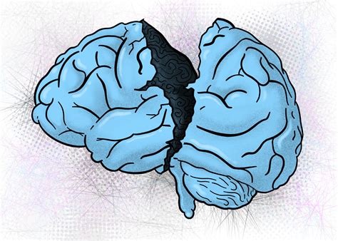 Mood and anxiety disorders share brain abnormalities