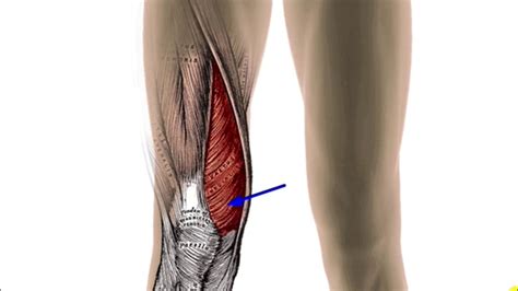 Vastus Medialis Trigger Points - YouTube