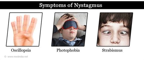 Nystagmus - Types, Causes, Symptoms, Diagnosis, Treatment & Prevention | Hereditary disorders ...