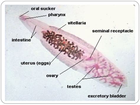 Clonorchiasis sinensis