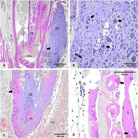 Histopathological feature of carotid body lesions. (A) Location of the ...