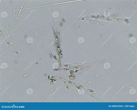 Diatoms, Algae Under Microscopic View, Phytoplankton, Fossils, Silica, Golden Yellow Algae Stock ...