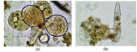 Observed microorganisms of activated sludge: (a) Stalked ciliates; (b ...