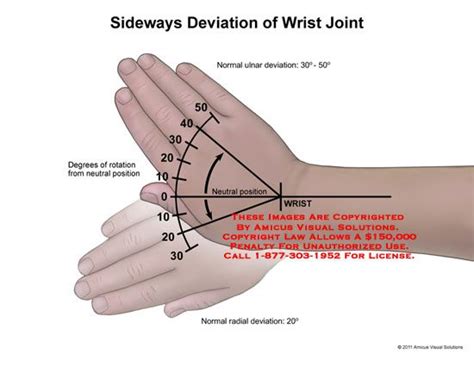 Imagen relacionada Hand Health, Body Health, Physical Therapy School, Occupational Therapy ...