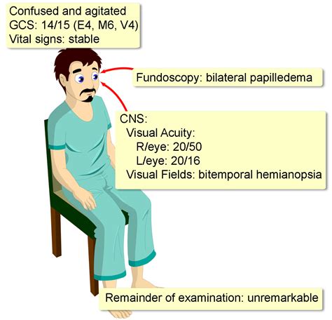 Pituitary Apoplexy - Interactive case study | Clinical Odyssey by Medical Joyworks, LLC