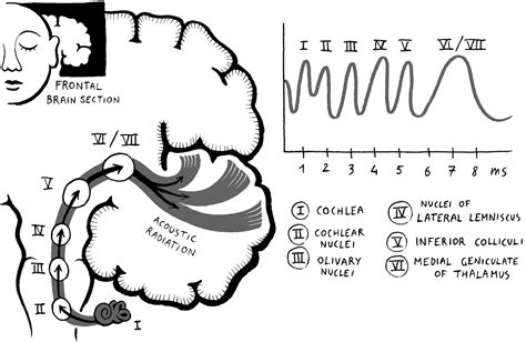 Experiment: The Auditory Brainstem Response