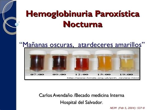 HEMOGLOBINURIA PAROXISTICA NOCTURNA PDF