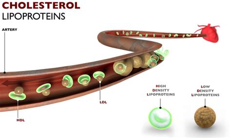 Familial hypercholesterolemia: MedlinePlus Genetics