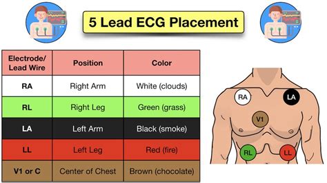 How to Place a 5 Lead ECG: Acronym, Mnemonic, Diagram for Electrode Placement Explained — EZmed