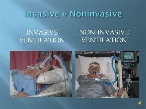 The Difference Between Invasive Ventilator And Non Invasive Ventilator | Images and Photos finder