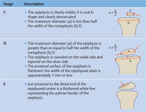 Skeletal Age | Radiology Key