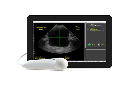 Point-of-Care USB Ultrasound for Bladder Scanning for Nursing & Long ...