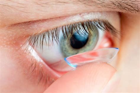 Contact Lens-Related Fungal Infections - The Eye News