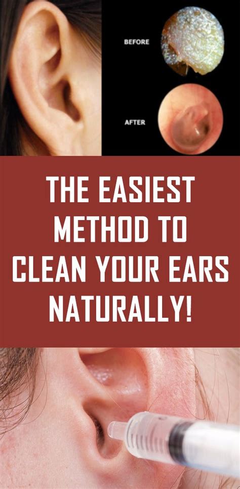 The Easiest Method To Clean Your Ears Naturally! | Cleaning your ears, Blocked ear remedies, Dry ...