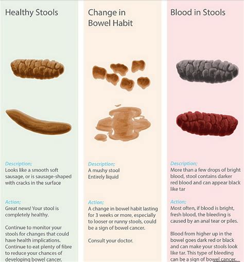 Chart reveals what your poo says about your health - Starts at 60