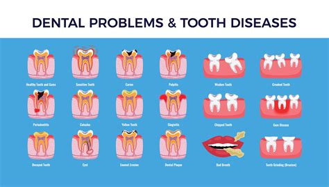 A Look into Common Dental Problems and Diseases in 2020 - Smile Angels of Beverly Hills