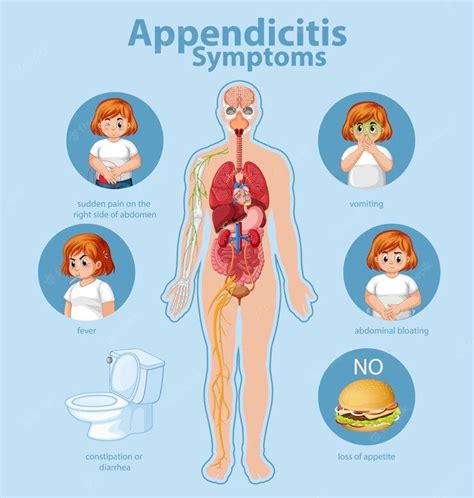 Need To Know About Appendix. Regular Appendix Location | by Prasanthvs | Medium