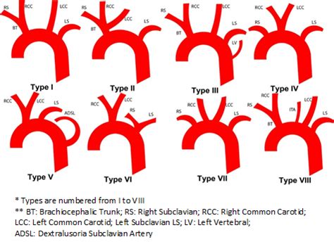 Anatomic variations of the branches of the aortic arch in a Peruvian ...