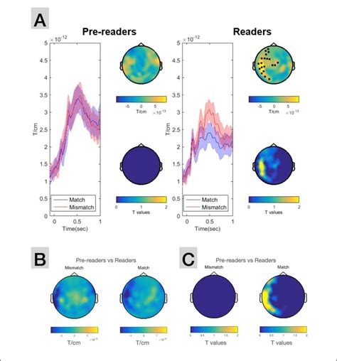 A: ERFs for the cross-sectional study. A: Grand average ERF responses ...