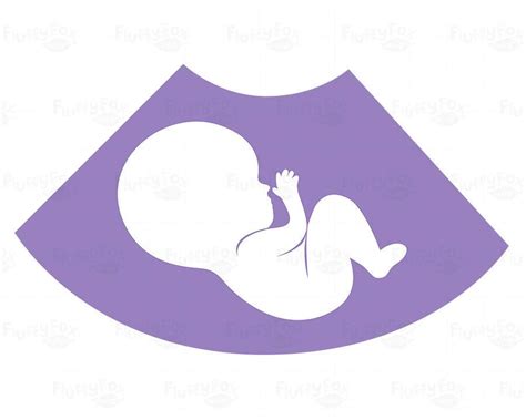 clipart ultrasound 20 free Cliparts | Download images on Clipground 2024