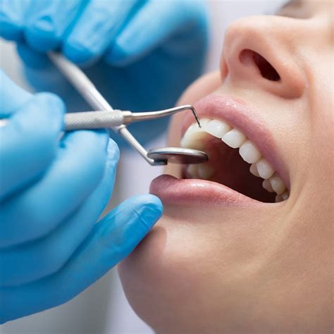 Full Mouth Debridement | Family Dentistry of Upper Marlboro