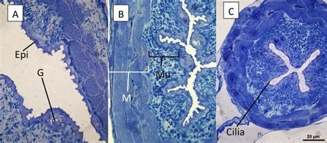 15: Three parts of the anterior esophagus of leptocephalus larvae of... | Download Scientific ...