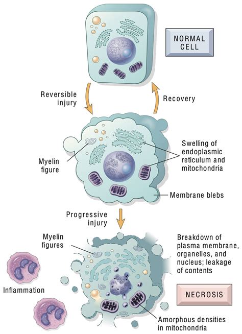 Necrosis and Apoptosis — What Are the Differences and Their ...