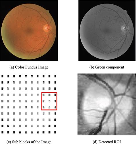 Localization of optic disc region | Download Scientific Diagram