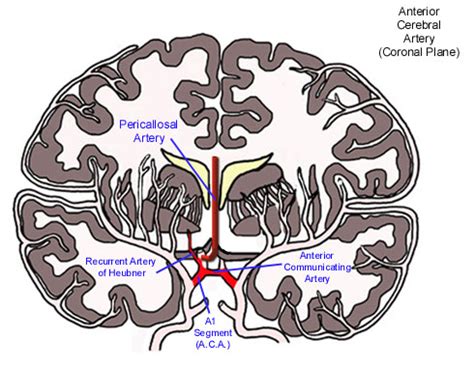 Anterior Cerebral Artery Stroke