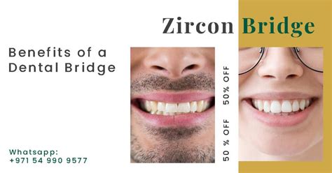 Benefits of a Dental Bridge - Dr. Sunny Medical Centre