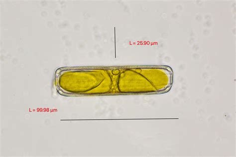 Pinnularia | The Microscopic Life of Shetland Lochs