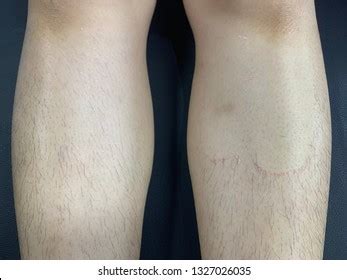 Waxing Before After Images, Stock Photos & Vectors | Shutterstock