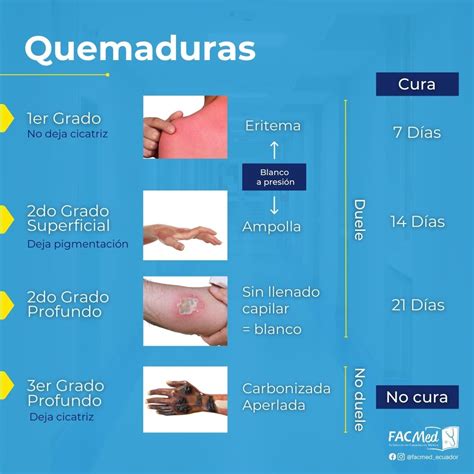 Facmed Ecuador - ⚠Clasificación de las quemaduras