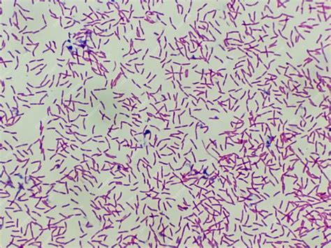 Premium Photo | Microscopic view of gram stain showing rod shape escherichia coli or e. coli ...
