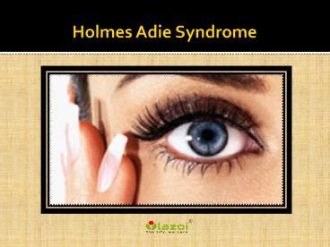 PPT – Holmes-Adie Syndrome (Adie’s Pupil): An overview of symptoms, causes, diagnosis and ...