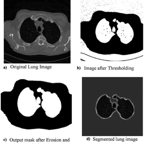 Pre-processing stages of the CT scan lung images: a input lung HU ...