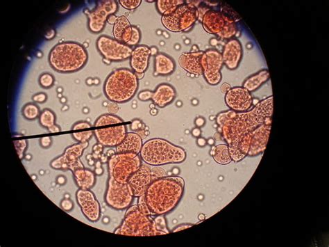 Difference Between Coacervates and Microspheres | Compare the Difference Between Similar Terms