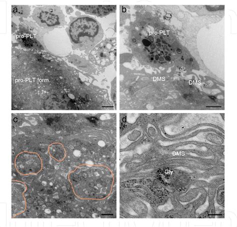 Figure 1 from Transmission Electron Microscopy of Platelets FROM ...