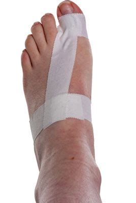 Turf Toe Taping | Turf toe, Middle toe, Natural pain relief