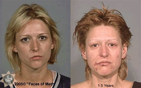 Celebrity Meth Heads