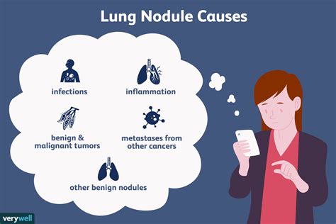 What Does Having a Nodule on the Lung Mean?