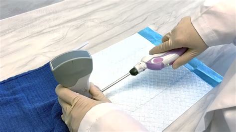 Mammotome® Elite Tetherless Vacuum-Assisted Biopsy Device Efficiency ...