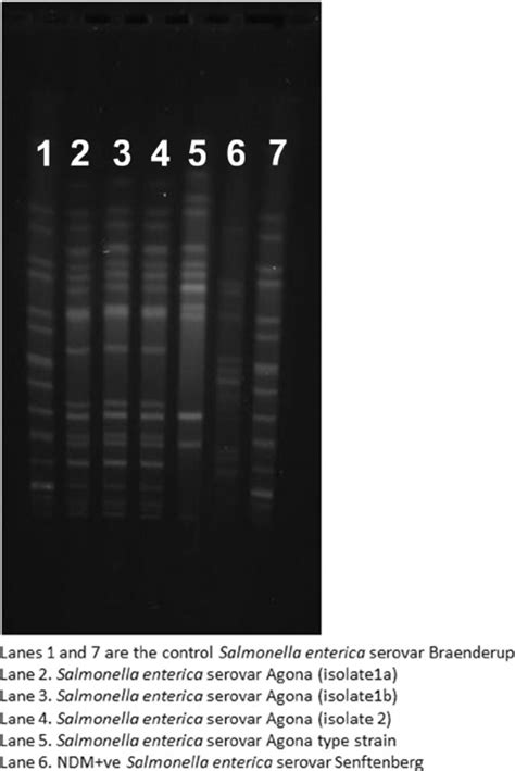 PFGE gel showing similarity of all three Salmonella enterica serovar... | Download Scientific ...