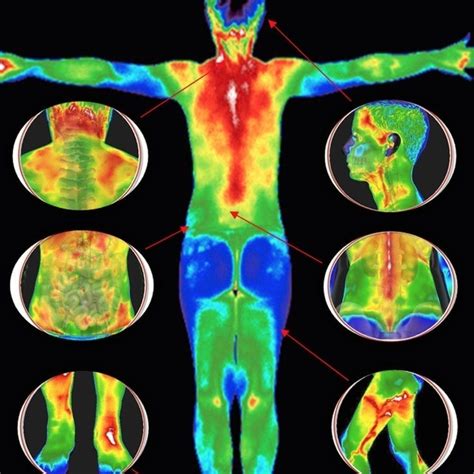 Thermography of Miami - Diagnostic Imaging - 9028 SW 152nd St, Miami ...