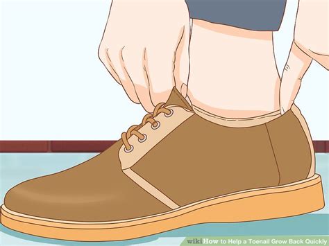 How to Help a Toenail Grow Back Quickly: 15 Steps (with Pictures)