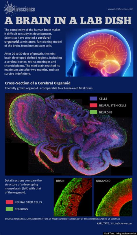 Human ‘Mini Brains’ Grown From Stem Cells In Lab Dish | We Wrestle Not With Flesh and Blood